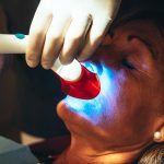 Sbiancamento dentale: quanto dura, vantaggi e svantaggi