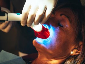 Sbiancamento_dentale_quanto_dura_vantaggi_e_svantaggi_dens_dentista_como_0a1bc207fd